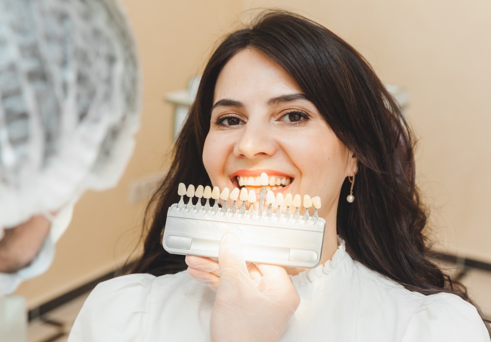 Professional teeth whitening