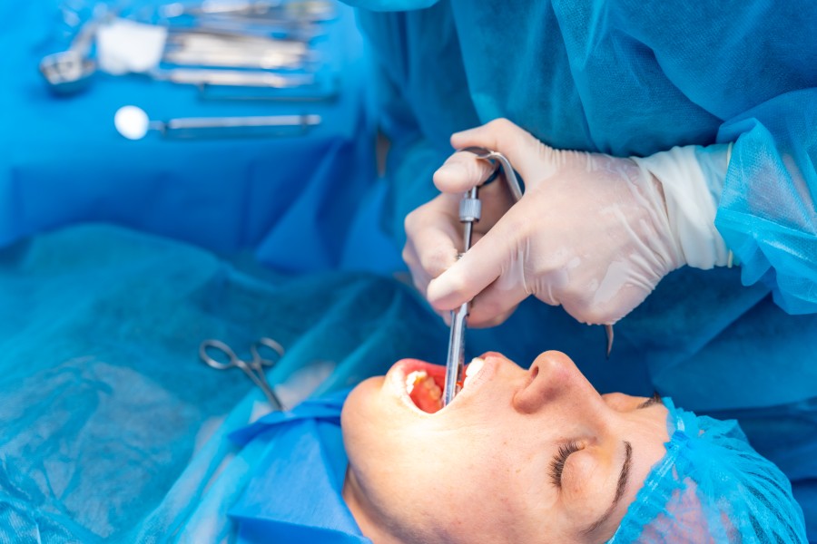 tooth extraction services